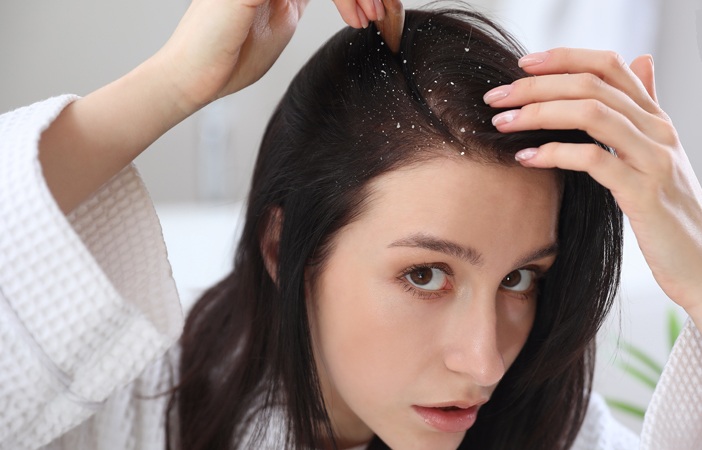How To Remove Dandruff from Hair
