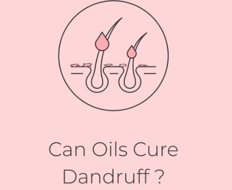 CAN OILS CURE DANDRUFF??